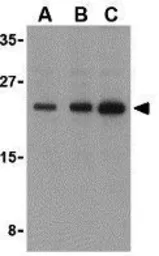 Anti-Bad antibody used in Western Blot (WB). GTX31688