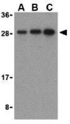 Anti-Bid antibody used in Western Blot (WB). GTX31689