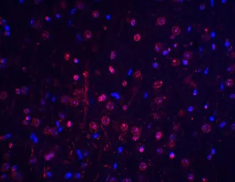 Anti-BTK antibody used in IHC (Paraffin sections) (IHC-P). GTX31694