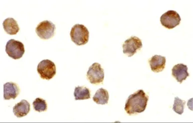 Anti-BTK antibody used in Immunocytochemistry/ Immunofluorescence (ICC/IF). GTX31694
