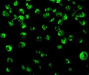 Anti-IRF8 antibody used in Immunocytochemistry/ Immunofluorescence (ICC/IF). GTX31696