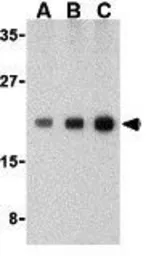 Anti-Caspase 1 antibody used in Western Blot (WB). GTX31702