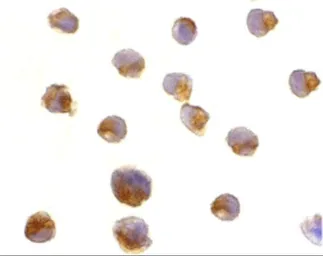 Anti-Caspase 6 antibody used in Immunocytochemistry/ Immunofluorescence (ICC/IF). GTX31707