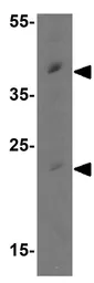 Anti-MCL1 antibody used in Western Blot (WB). GTX31708