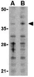 Anti-MCL1 antibody used in Western Blot (WB). GTX31709