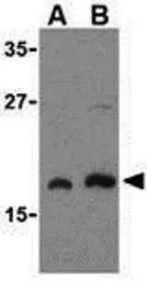 Anti-mLST8 / GBL antibody used in Western Blot (WB). GTX31711