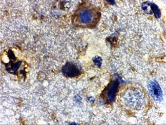 Anti-Rheb antibody used in IHC (Paraffin sections) (IHC-P). GTX31713