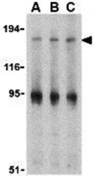 Anti-IRS1 antibody used in Western Blot (WB). GTX31717
