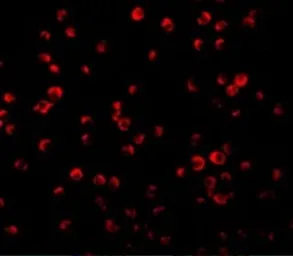 Anti-IRS1 antibody used in Immunocytochemistry/ Immunofluorescence (ICC/IF). GTX31717