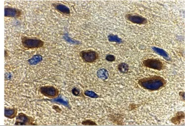 Anti-Adiponectin antibody used in IHC (Paraffin sections) (IHC-P). GTX31718