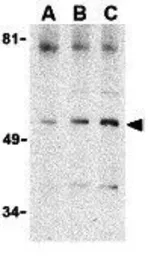 Anti-Beclin 1 antibody used in Western Blot (WB). GTX31721