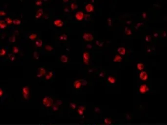 Anti-Beclin 1 antibody used in Immunocytochemistry/ Immunofluorescence (ICC/IF). GTX31721