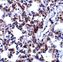 Anti-BCAP31 antibody used in IHC (Paraffin sections) (IHC-P). GTX31725