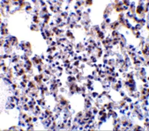 Anti-BCAP31 antibody used in IHC (Paraffin sections) (IHC-P). GTX31726