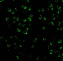 Anti-ASK1 antibody used in Immunocytochemistry/ Immunofluorescence (ICC/IF). GTX31727