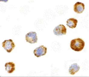 Anti-ASK1 antibody used in Immunocytochemistry/ Immunofluorescence (ICC/IF). GTX31727