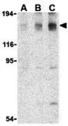 Anti-ASK1 antibody used in Western Blot (WB). GTX31728