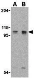 Anti-LSD1 antibody used in Western Blot (WB). GTX31730