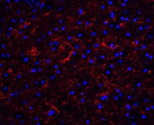 Anti-Clusterin antibody used in IHC (Paraffin sections) (IHC-P). GTX31733