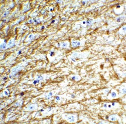 Anti-Clusterin antibody used in IHC (Paraffin sections) (IHC-P). GTX31733