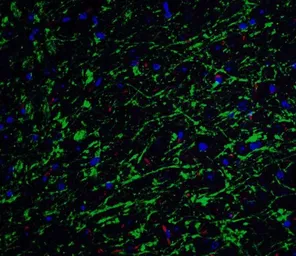 Anti-Clusterin antibody used in IHC (Paraffin sections) (IHC-P). GTX31733