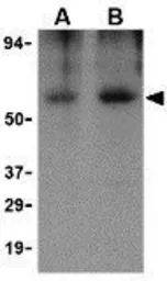 Anti-Clusterin antibody used in Western Blot (WB). GTX31733