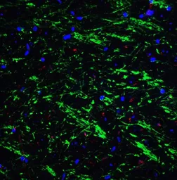 Anti-Bag1 antibody used in IHC (Paraffin sections) (IHC-P). GTX31736