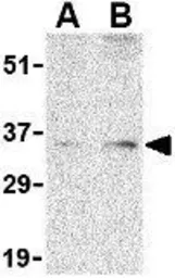 Anti-Bag1 antibody used in Western Blot (WB). GTX31737