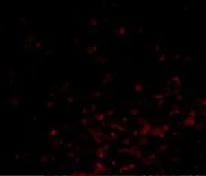 Anti-Bag1 antibody used in IHC (Paraffin sections) (IHC-P). GTX31737