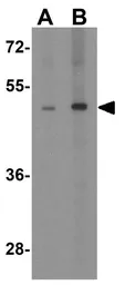 Anti-TANK antibody used in Western Blot (WB). GTX31740