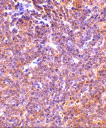 Anti-PAK2 antibody used in IHC (Paraffin sections) (IHC-P). GTX31742