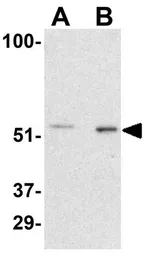 Anti-PAK2 antibody used in Western Blot (WB). GTX31742