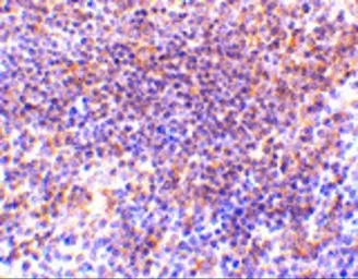 Anti-PAK2 antibody used in IHC (Paraffin sections) (IHC-P). GTX31743