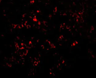 Anti-PAK2 antibody used in IHC (Paraffin sections) (IHC-P). GTX31743