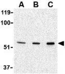 Anti-PAK2 antibody used in Western Blot (WB). GTX31743