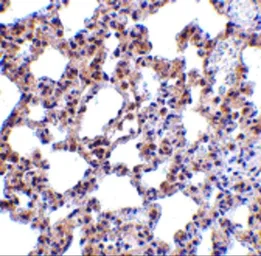 Anti-PKR antibody used in IHC (Paraffin sections) (IHC-P). GTX31746