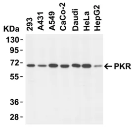 Anti-PKR antibody used in Western Blot (WB). GTX31746