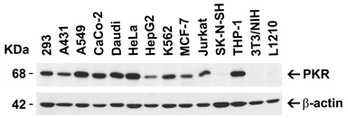 Anti-PKR antibody used in Western Blot (WB). GTX31746