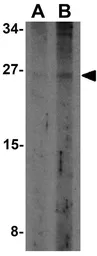Anti-TWEAKR antibody used in Western Blot (WB). GTX31747