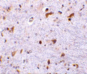 Anti-PDCD4 antibody used in IHC (Paraffin sections) (IHC-P). GTX31750