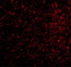 Anti-Nicastrin antibody used in IHC (Paraffin sections) (IHC-P). GTX31751