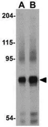 Anti-Nicastrin antibody used in Western Blot (WB). GTX31752