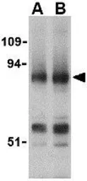 Anti-Blimp1 antibody used in Western Blot (WB). GTX31755