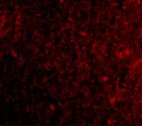 Anti-PD1 antibody used in IHC (Paraffin sections) (IHC-P). GTX31756