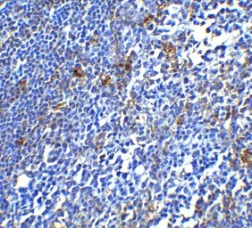 Anti-PD1 antibody used in IHC (Paraffin sections) (IHC-P). GTX31756