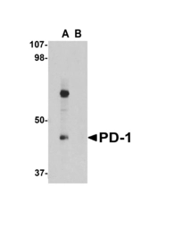 Anti-PD1 antibody used in Western Blot (WB). GTX31756