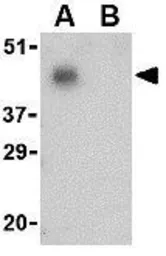 Anti-PD1 antibody used in Western Blot (WB). GTX31756