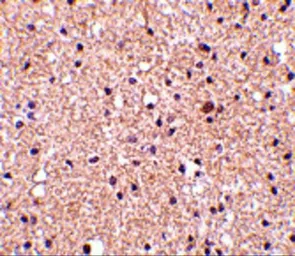 Anti-Stathmin 1 antibody used in IHC (Paraffin sections) (IHC-P). GTX31759