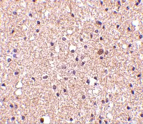 Anti-Stathmin 1 antibody used in IHC (Paraffin sections) (IHC-P). GTX31759