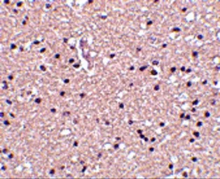 Anti-Stathmin 1 antibody used in IHC (Paraffin sections) (IHC-P). GTX31760
